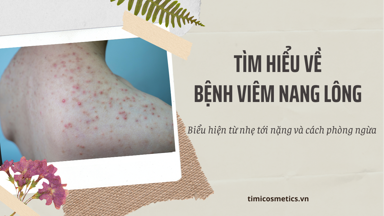 BÍ QUYẾT ĐÁNH BAY VIÊM NANG LÔNG VỚI BỘ SẢN PHẨM YEOSA BÍ QUYẾT ĐÁNH BAY VIÊM NANG LÔNG VỚI BỘ SẢN PHẨM YEOSA