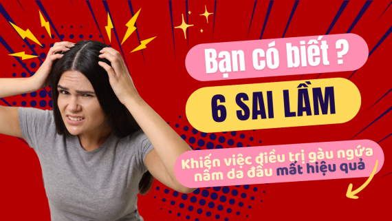 6 SAI LẦM CẦN TRÁNH KHI TRỊ GÀU, NẤM DA ĐẦU VÀ VIÊM DA TIẾT BÃ
